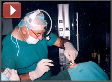 metode uvulopalatofaringoplastika