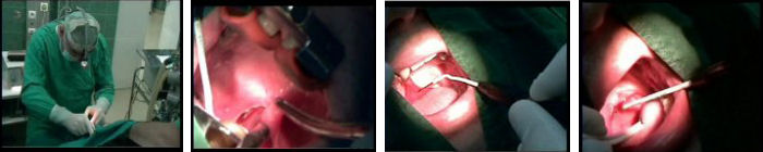 Hirur&scaron;ko lečenje bučnog sna, Dr, Vukoje, Novi sad, Srbija